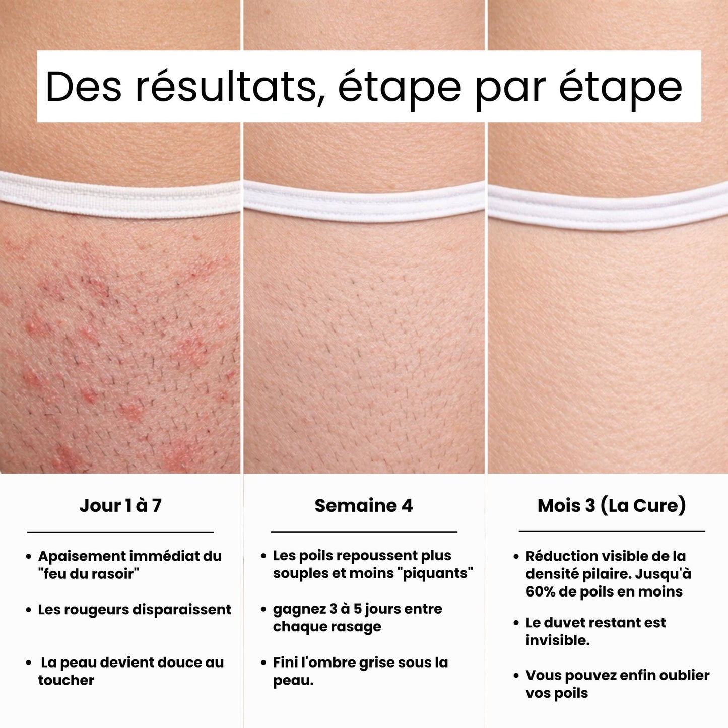 Sérum naturel réducteur de repousse