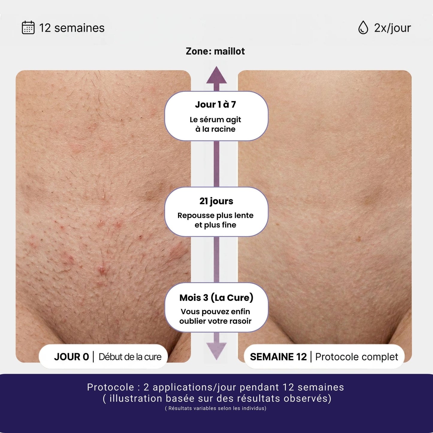 Sérum naturel réducteur de repousse