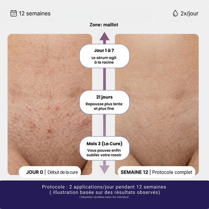 Sérum naturel réducteur de repousse